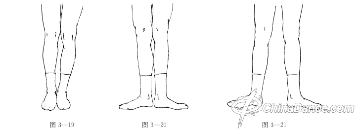 【教师课堂】儿童舞蹈教学 脚位的规范