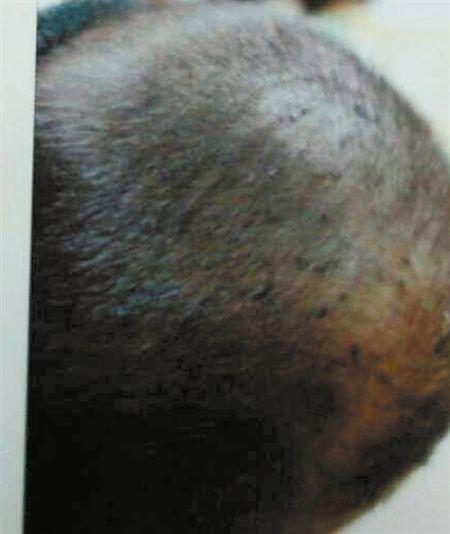 3岁娃被保姆虐待多处留疤 靠谱保姆怎么找
