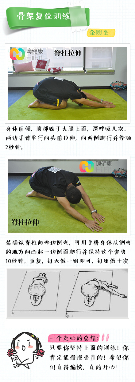 嗨健康课堂 权威整骨之脊柱侧弯矫正
