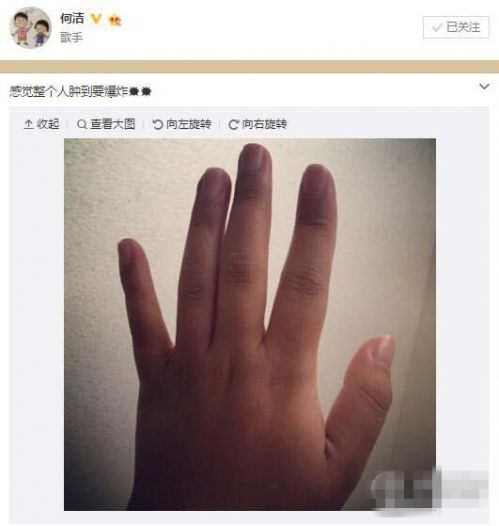 何洁怀二胎近六个月 感叹整个人水肿到要爆炸
